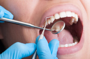 Person getting a dental cleaning