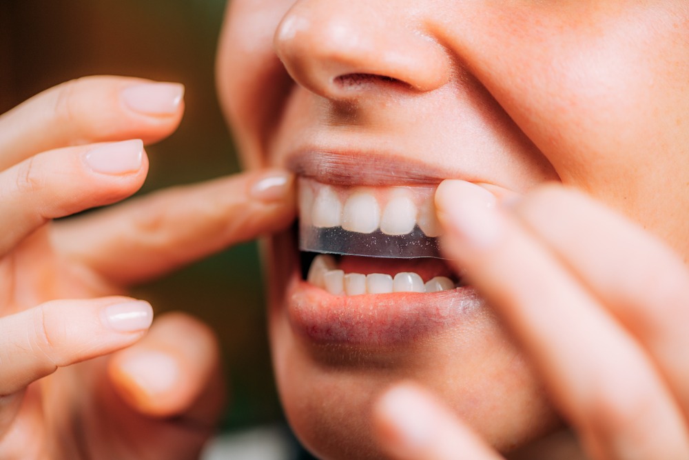 A woman applies a whitening strip to her top teeth.